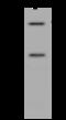 Kinesin Family Member C1 antibody, 200528-T40, Sino Biological, Western Blot image 