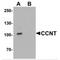 Cyclin T1 antibody, MBS153518, MyBioSource, Western Blot image 
