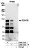 Zinc Finger CCCH-Type Containing 7B antibody, A305-133A, Bethyl Labs, Immunoprecipitation image 