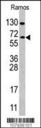 Cell Division Cycle 25B antibody, 62-765, ProSci, Western Blot image 