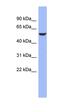 CUGBP Elav-Like Family Member 4 antibody, orb324913, Biorbyt, Western Blot image 