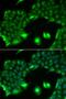 SSX Family Member 2B antibody, LS-C334977, Lifespan Biosciences, Immunofluorescence image 