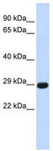 Chymotrypsinogen B1 antibody, TA334722, Origene, Western Blot image 
