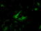 Keratin 8 antibody, GTX84248, GeneTex, Immunocytochemistry image 