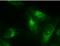 Microtubule Associated Protein 1 Light Chain 3 Alpha antibody, BML-PW1205-0025, Enzo Life Sciences, Immunofluorescence image 
