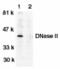 Deoxyribonuclease 2 Beta antibody, AHP1592, Bio-Rad (formerly AbD Serotec) , Immunohistochemistry paraffin image 
