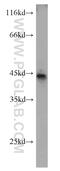 Beta-1,3-N-Acetylgalactosaminyltransferase 1 (Globoside Blood Group) antibody, 22048-1-AP, Proteintech Group, Western Blot image 