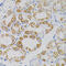 Mitochondrially Encoded Cytochrome C Oxidase II antibody, 23-118, ProSci, Immunohistochemistry paraffin image 