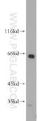 Sestrin-2 antibody, 21346-1-AP, Proteintech Group, Western Blot image 