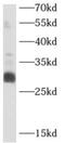 APAF1 Interacting Protein antibody, FNab00483, FineTest, Western Blot image 