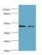 CHRNA7 (Exons 5-10) And FAM7A (Exons A-E) Fusion antibody, MBS1498484, MyBioSource, Western Blot image 