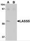 Ceramide Synthase 5 antibody, 4695, ProSci Inc, Western Blot image 