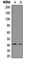 C-C Motif Chemokine Receptor 5 (Gene/Pseudogene) antibody, LS-C354595, Lifespan Biosciences, Western Blot image 