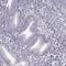 Chromosome 16 Open Reading Frame 86 antibody, HPA073475, Atlas Antibodies, Immunohistochemistry frozen image 