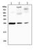 C-Reactive Protein antibody, A00249-1, Boster Biological Technology, Western Blot image 