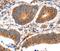 Myosin Heavy Chain 7 antibody, PA5-50240, Invitrogen Antibodies, Immunohistochemistry paraffin image 