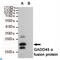 Growth arrest and DNA damage-inducible protein GADD45 alpha antibody, LS-C812977, Lifespan Biosciences, Western Blot image 