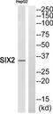 Homeobox protein SIX2 antibody, TA312702, Origene, Western Blot image 
