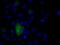 Atrial natriuretic peptide receptor 3 antibody, GTX84010, GeneTex, Immunofluorescence image 