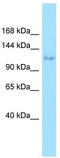 Ephrin type-A receptor 6 antibody, TA338322, Origene, Western Blot image 