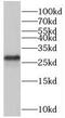 Origin Recognition Complex Subunit 6 antibody, FNab06009, FineTest, Western Blot image 
