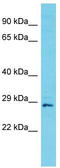Cilia And Flagella Associated Protein 300 antibody, TA331690, Origene, Western Blot image 