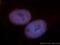 Methyl-CpG Binding Domain Protein 3 antibody, 14258-1-AP, Proteintech Group, Immunofluorescence image 