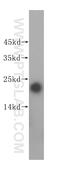 O-6-Methylguanine-DNA Methyltransferase antibody, 17195-1-AP, Proteintech Group, Western Blot image 