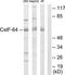 Cleavage Stimulation Factor Subunit 2 antibody, TA311679, Origene, Western Blot image 