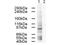 AP-1 complex subunit gamma-1 antibody, PA1-31775, Invitrogen Antibodies, Western Blot image 