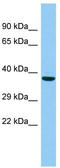 Chromosome 7 Open Reading Frame 57 antibody, TA332205, Origene, Western Blot image 