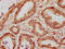WAPL Cohesin Release Factor antibody, CSB-PA772025LA01HU, Cusabio, Immunohistochemistry paraffin image 