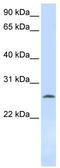Deoxycytidine kinase antibody, TA339941, Origene, Western Blot image 