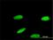 Zinc Finger Protein 587 antibody, H00084914-M01, Novus Biologicals, Immunofluorescence image 