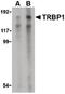 TAR (HIV-1) RNA Binding Protein 1 antibody, PA5-20331, Invitrogen Antibodies, Western Blot image 