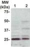 Rho GDP-dissociation inhibitor 1 antibody, TA354870, Origene, Western Blot image 