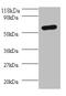 Sep (O-Phosphoserine) TRNA:Sec (Selenocysteine) TRNA Synthase antibody, A52925-100, Epigentek, Western Blot image 
