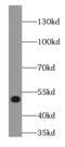 Lpa3 antibody, FNab02635, FineTest, Western Blot image 