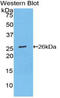 BCL2 antibody, LS-C301768, Lifespan Biosciences, Western Blot image 