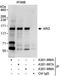 ABL Proto-Oncogene 2, Non-Receptor Tyrosine Kinase antibody, A301-987A, Bethyl Labs, Immunoprecipitation image 