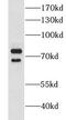 CLINT1 antibody, FNab01762, FineTest, Western Blot image 
