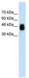 Homer protein homolog 1 antibody, TA345673, Origene, Western Blot image 