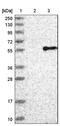 Arylacetamide Deacetylase antibody, NBP1-85680, Novus Biologicals, Western Blot image 