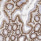 Sad1 And UNC84 Domain Containing 2 antibody, HPA001209, Atlas Antibodies, Immunohistochemistry paraffin image 