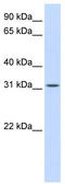 BCAS2 Pre-MRNA Processing Factor antibody, TA345935, Origene, Western Blot image 