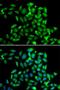 Cytoplasmic Linker Associated Protein 1 antibody, LS-C346219, Lifespan Biosciences, Immunofluorescence image 