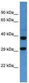Sst2 antibody, TA342652, Origene, Western Blot image 