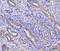 Ribosomal Protein L29 antibody, A05949-1, Boster Biological Technology, Immunohistochemistry paraffin image 