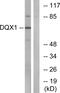DEAQ-Box RNA Dependent ATPase 1 antibody, GTX87145, GeneTex, Western Blot image 