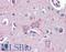 Sclerostin antibody, LS-B3456, Lifespan Biosciences, Immunohistochemistry paraffin image 